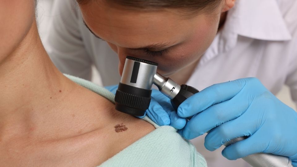 ablativ-lazer-ile-ben-tedavisi